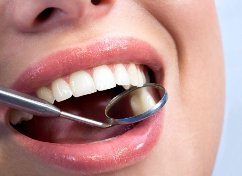 Broken Teeth Repairs in Lynn, MA